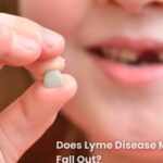 does lyme disease make your teeth fall out​